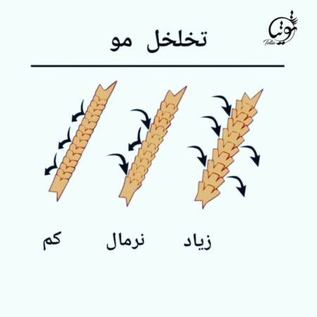 تخلخل متوسط یا طبیعی